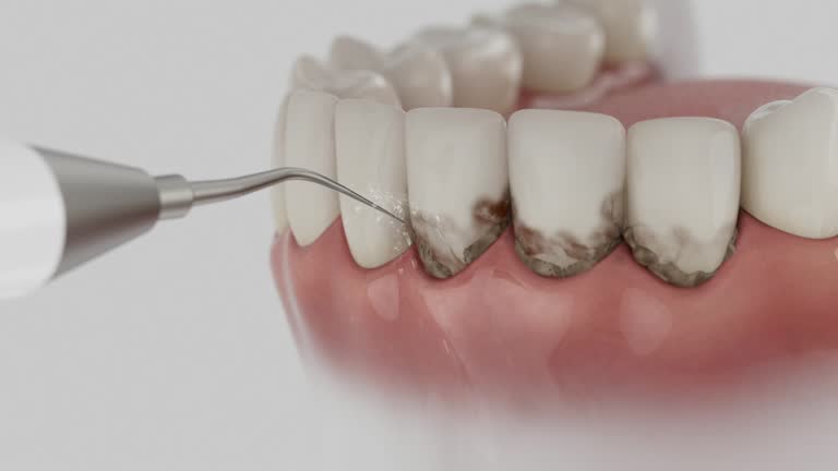 Trusted Root Canal Treatment service in Gantt, SC - Dentist Open Now
